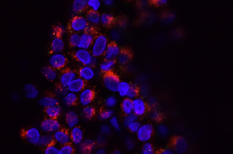 national-cancer-institute-evhLgfOjU5Y-unsplash